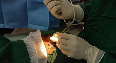 Alman mahkemesi, Türkiye'de katarakt ameliyatı olanı yaktı